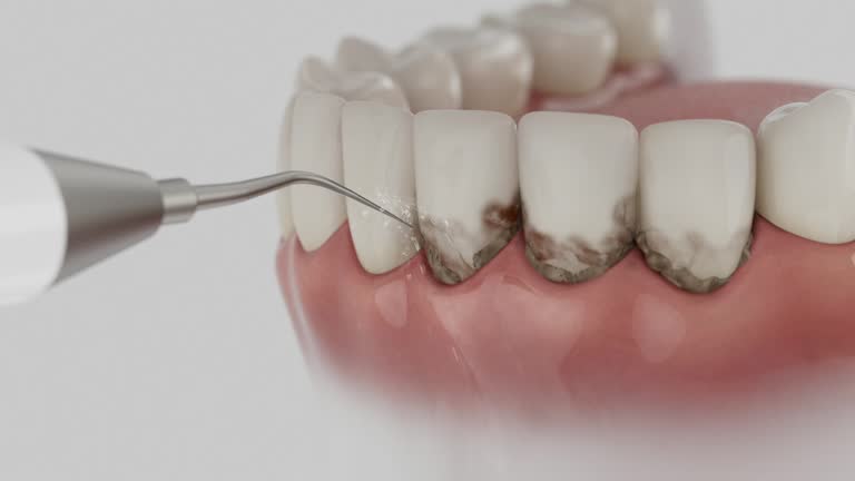 Reliable Tooth Extraction contractor in Laurens County County, GA by Dentist Open Now